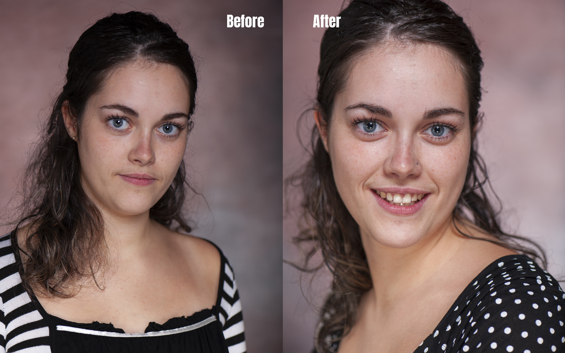  Therapy shooting in studio 